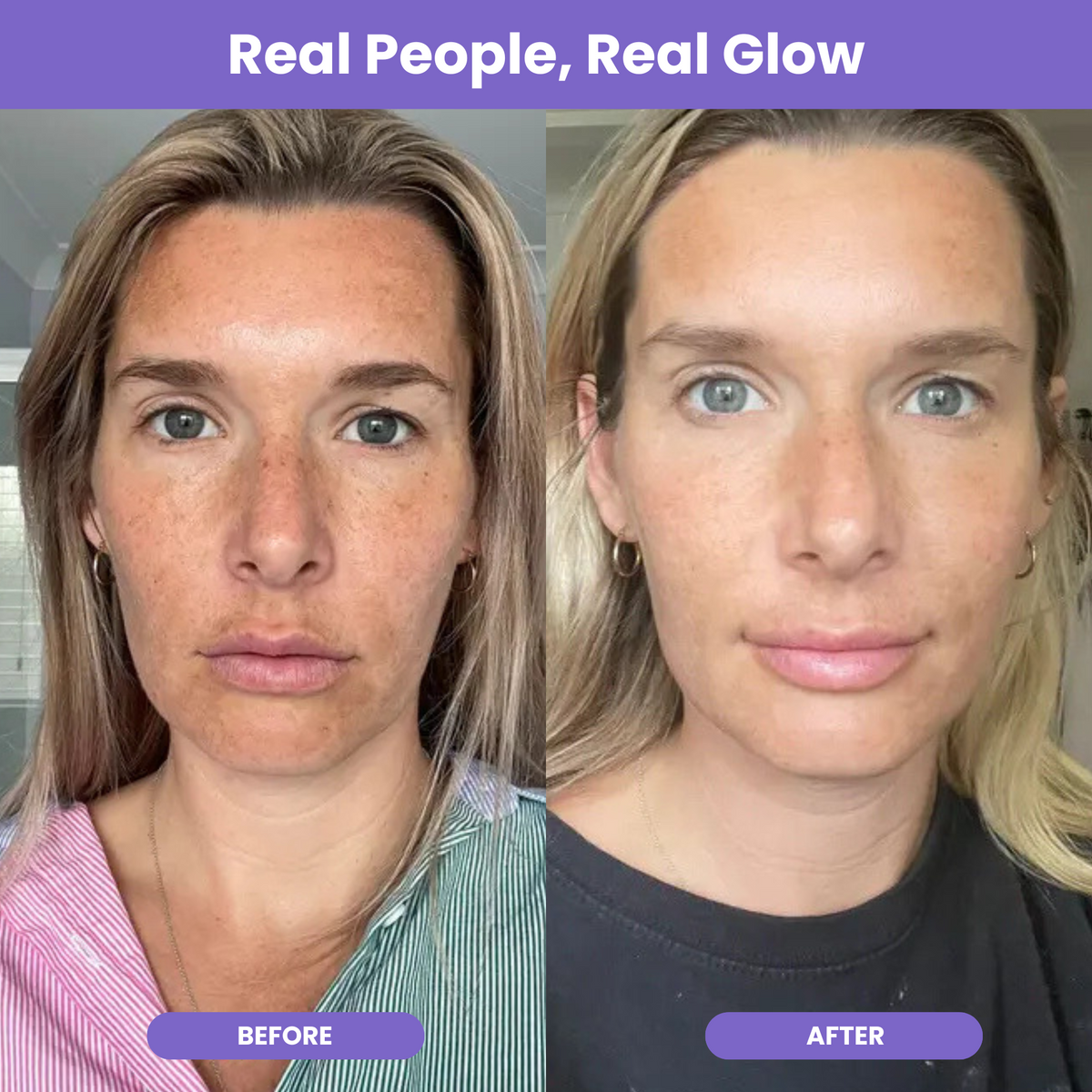 NutraGlow Multi Collagen Peptides