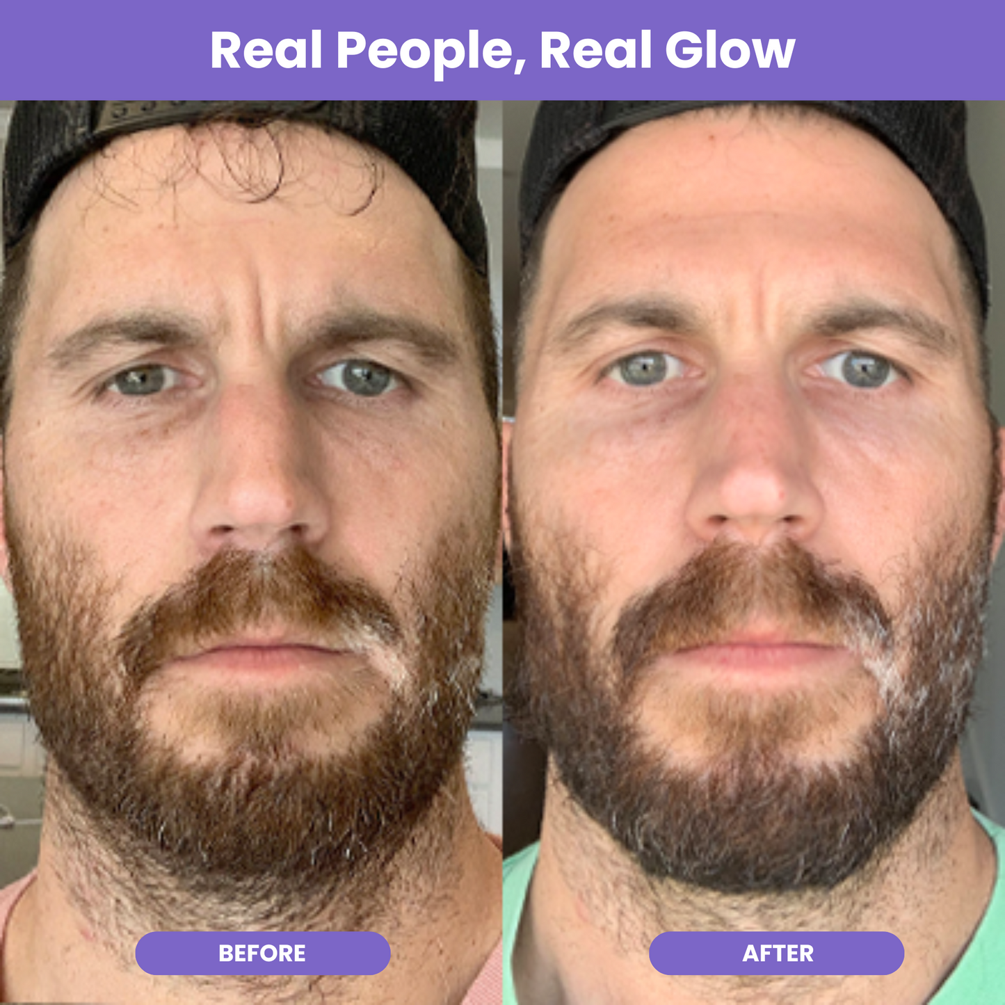NutraGlow Multi Collagen Anti-Aging Blend