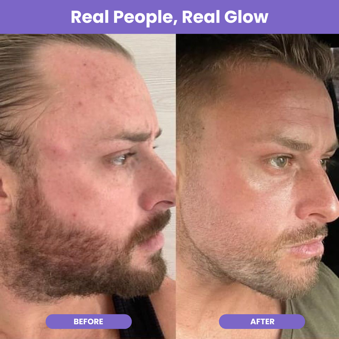 NutraGlow Multi Collagen Anti-Aging Blend