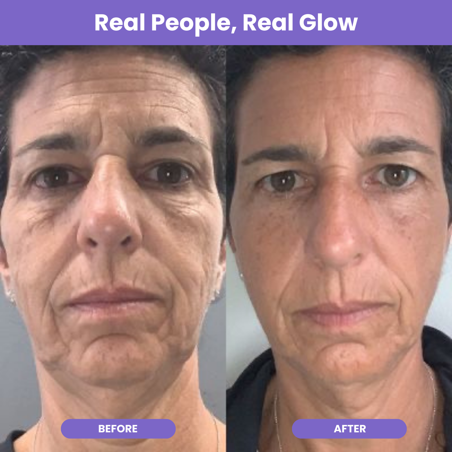 NutraGlow Multi Collagen Anti-Aging Blend